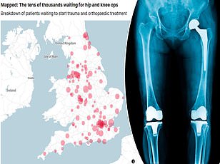 Groundbreaking Study Reveals Biological Explanation for Women's Higher Chronic Pain Risk in the UK