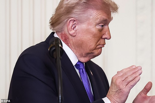 President Trump's Neck Rash Sparks Health Speculation Amid Preventative Treatment