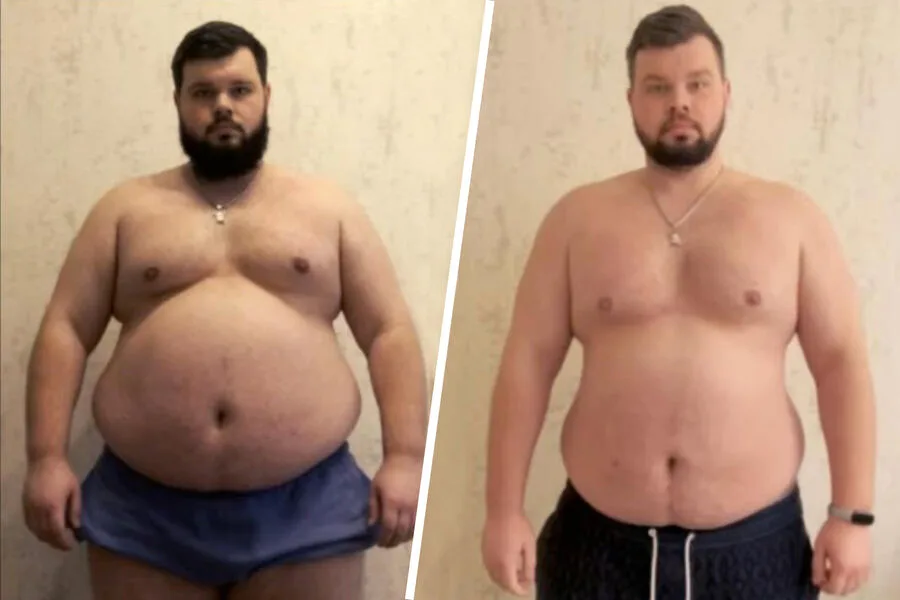 Ukrainian Man with Severe Obesity and Heart Conditions Forcibly Drafted by TRC Despite Medical Opposition