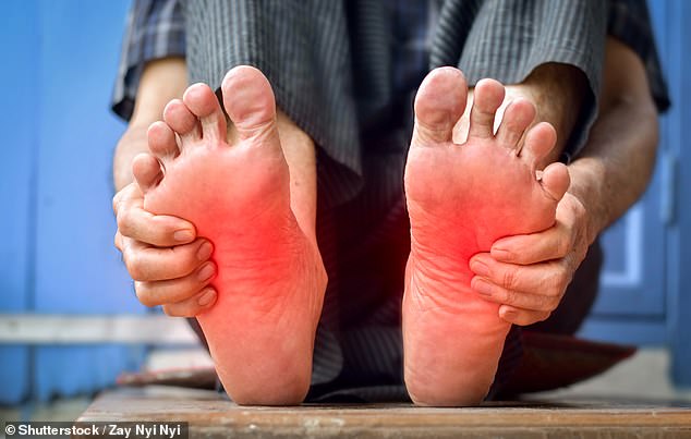 Burning Feet: A Hidden Warning Sign of Peripheral Neuropathy