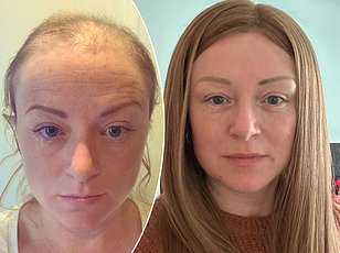 Grey Hair Could Be a Silent Alarm for Cancer, Study Reveals