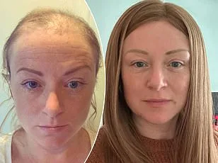 Grey Hair Could Be a Silent Alarm for Cancer, Study Reveals