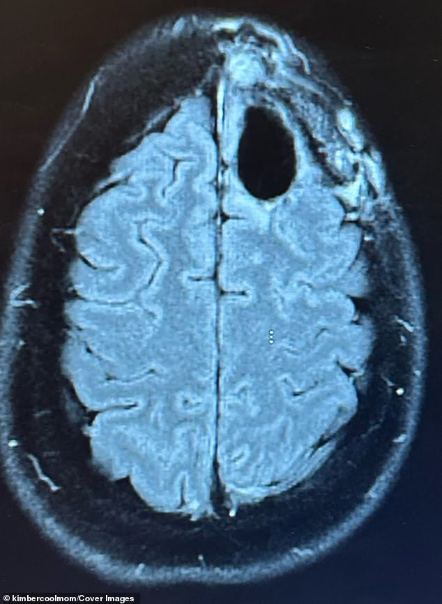 Defying the Odds: Kimberly Pelling's Radical Fight Against Aggressive Brain Cancer