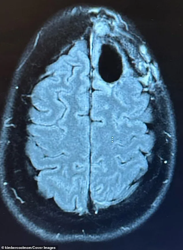 Defying the Odds: Kimberly Pelling's Radical Fight Against Aggressive Brain Cancer