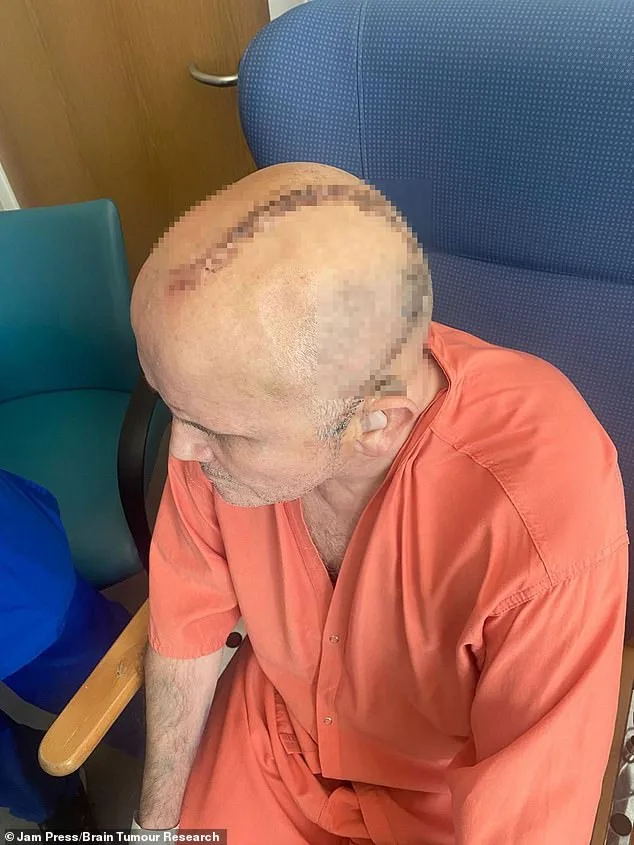 Stuart Hill's Silent Warning: How Decades of Migraines Masked a Life-Threatening Condition