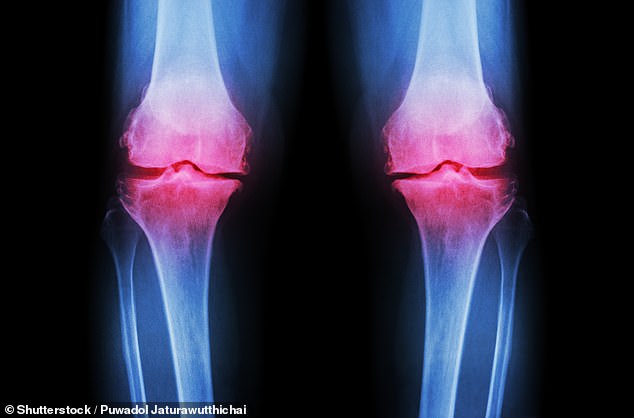 Daily 6p Fibre Supplement Shows Promise in Reducing Osteoarthritis Knee Pain