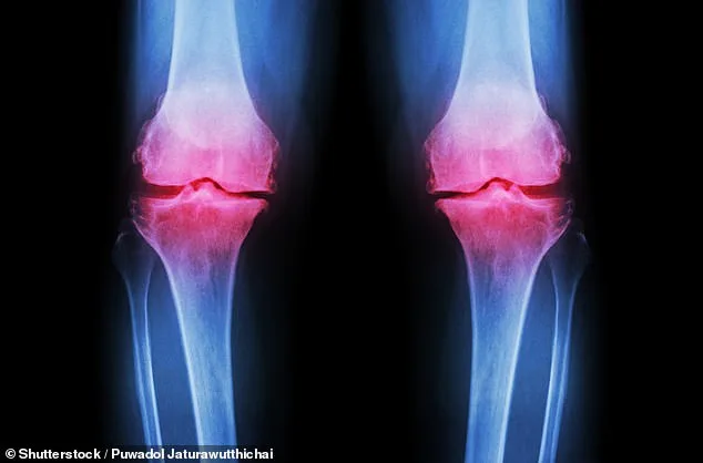 Daily 6p Fibre Supplement Shows Promise in Reducing Osteoarthritis Knee Pain
