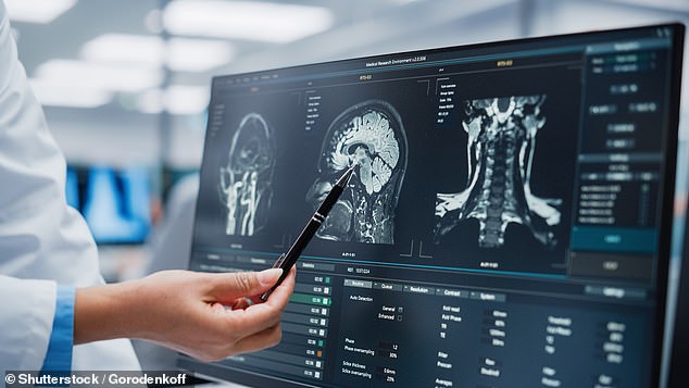 When Headaches Are a Medical Emergency: Recognizing the Red Flags