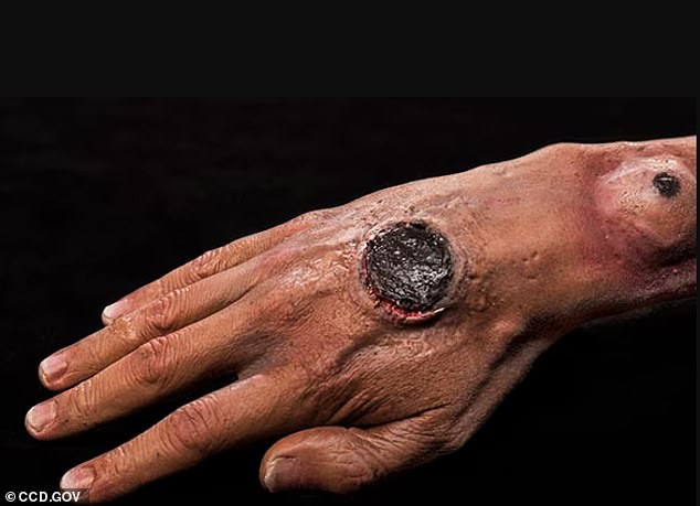 Deadly Anthrax Bacteria Found in Soil Across 43 States: Scientists Warn Disturbing It Could Trigger Outbreaks