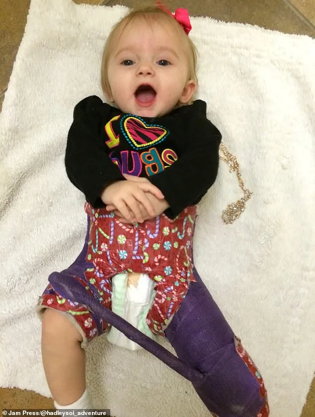 Shattered Joy: Baby's Fractures Lead to Abuse Accusations for Parents