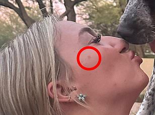 Shattered Joy: Baby's Fractures Lead to Abuse Accusations for Parents