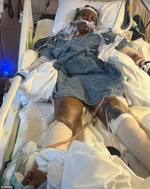 Mississippi Woman's Tragic Death After Dog Attack Sparks Legal Scrutiny and Public Concern