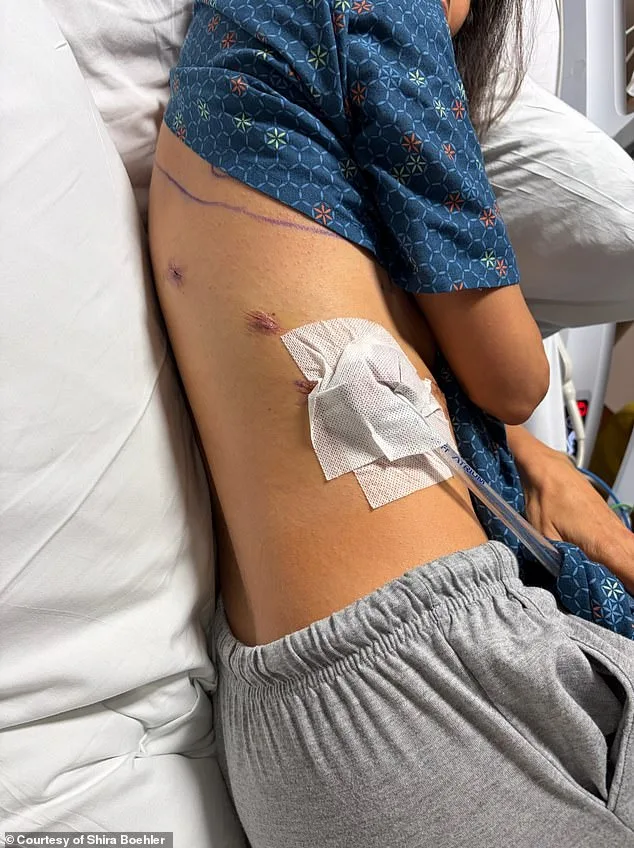 Alarming Surge in Lung Cancer Cases Among Non-Smokers and Healthy Young People