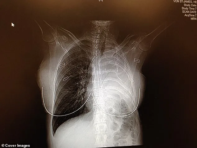 From Comfort to Crisis: How a Father's Work Coat Led to a Terminal Diagnosis