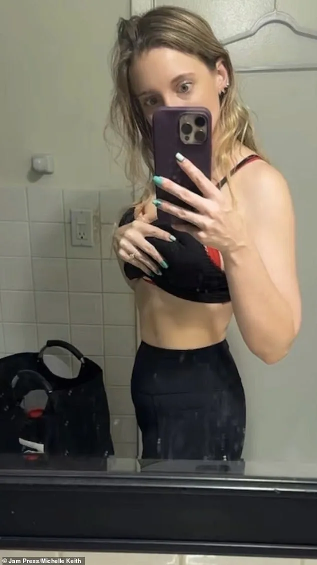 Michelle Keith's Postpartum Struggle with Lipoedema: A Chronic, Incurable Battle