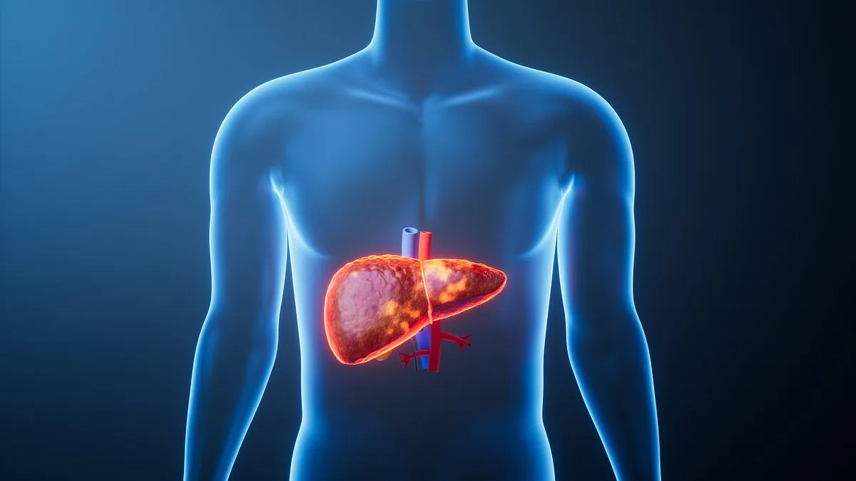 Liver Disease Among Non-Drinkers Surpasses Alcohol-Related Cases