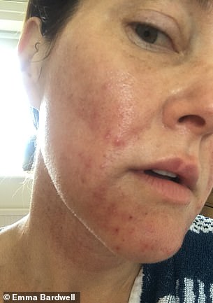 Nutritionist Emma Bardwell Overcomes Perimenopause Crisis to Reclaim Her Life