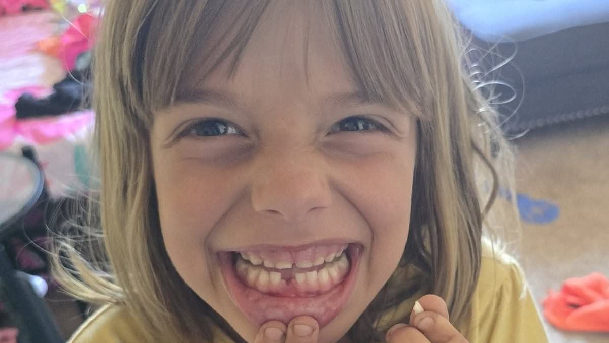 Seven-year-old girl suffers catastrophic injuries after pack of six stray dogs attacks.