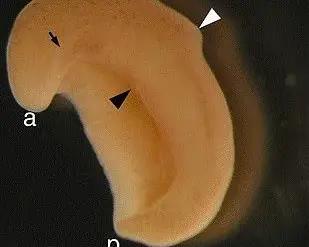Breakthrough Discovery Traces Human Anus Evolution Back 550 Million Years