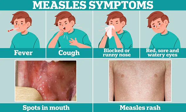 Measles Case Reported in Washington D.C.; Health Officials Warn of Possible Exposure Sites