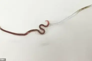 Park Soil Contamination: Roundworm Eggs Found at Entrances and Playgrounds in Dublin Parks
