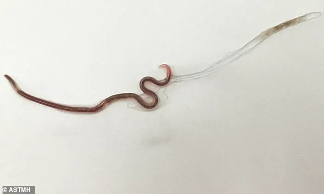 Park Soil Contamination: Roundworm Eggs Found at Entrances and Playgrounds in Dublin Parks