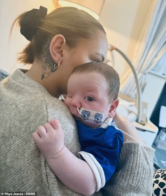 Rare Syndrome Leaves Baby With an Ear on His Cheek