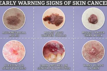Tattoos Linked to Up to 62% Higher Risk of Skin Cancer, Study Finds