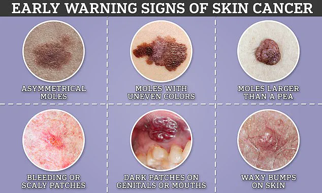 Tattoos Linked to Up to 62% Higher Risk of Skin Cancer, Study Finds