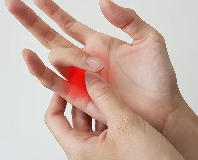 Understanding Trigger Finger: Symptoms and Impact on Joint Movement