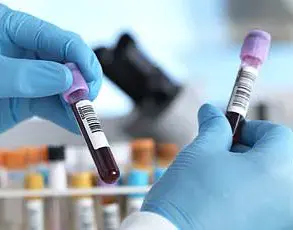 Exclusive Findings: Statin Use Linked to Reduced Risk of Blood Cancer and Mortality