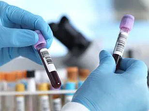 Exclusive Findings: Statin Use Linked to Reduced Risk of Blood Cancer and Mortality