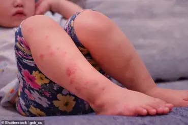 Fifty People Potentially Exposed to Measles in Michigan After Infected Baby's Public Outings