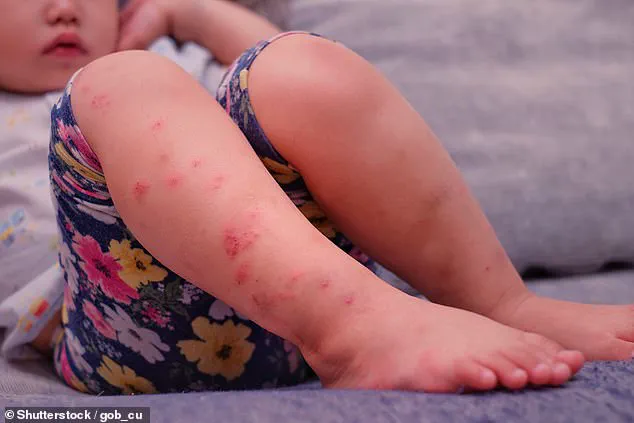 Fifty People Potentially Exposed to Measles in Michigan After Infected Baby's Public Outings