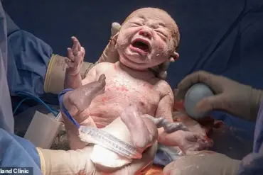 Hope for Infertility: The Life-Changing Reality of Uterine Transplants