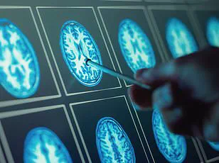 Lowering Blood Pressure Cuts Dementia Risk by 15%, Major Study Finds