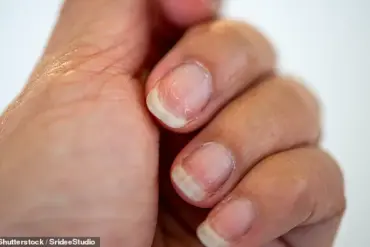 Your Nails May Be Hiding Serious Health Issues: What to Look Out For