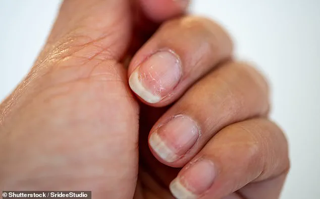 Your Nails May Be Hiding Serious Health Issues: What to Look Out For
