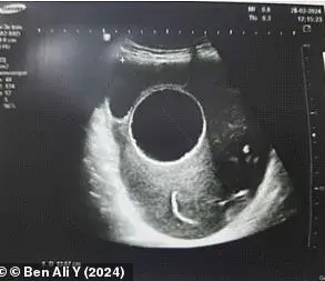 Public Health Officials Urge Pet Hygiene Measures After Tunisian Pregnancy Complication