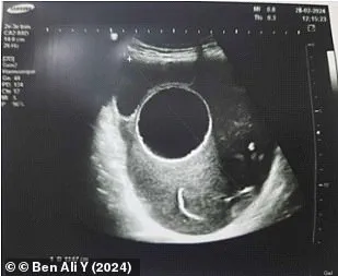 Public Health Officials Urge Pet Hygiene Measures After Tunisian Pregnancy Complication