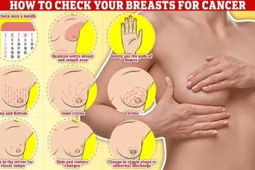 Exclusive Access to Groundbreaking Breast Cancer Drug That Destroys Tumors Before Growth