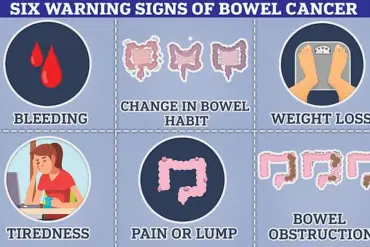 Study Links White Bread, Processed Meats, and Sugary Drinks to Increased Colon Cancer Risk, Adding to Growing Evidence on Diet's Role in Cancer Outcomes