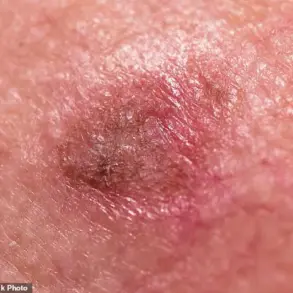 Understanding Skin Health: A Guide to Recognizing and Addressing Common Dermatological Concerns