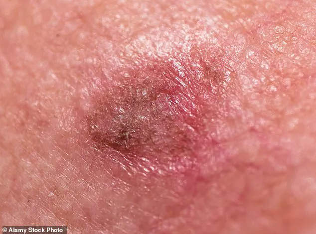Understanding Skin Health: A Guide to Recognizing and Addressing Common Dermatological Concerns