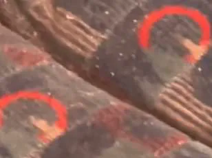 Urgent Warning: Holidaymakers Risk Scabies Exposure by Leaving Luggage on Hotel Beds in Victoria