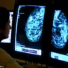 Alarming Study Reveals Link Between Certain Hormone Replacement Therapies and Elevated Breast Cancer Risk in Younger Women, Published in The Lancet Oncology