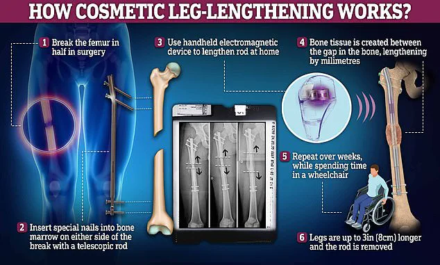 Exclusive: The Controversial Journey of a Man Who Stretched His Legs to Break World Records
