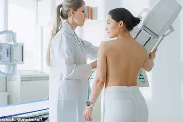 Late-Breaking Study: Breast Cancer Radiotherapy Linked to 8% Lower Alzheimer's Risk, Offering New Hope for Neurodegenerative Disease Prevention