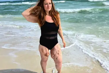 Privileged Access: How Lexi Reed's Weight Loss Journey Redefined Body Positivity and Resilience
