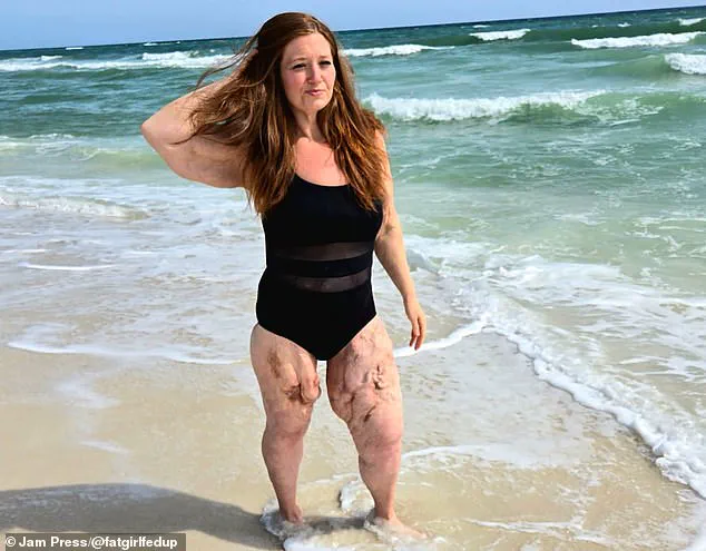 Privileged Access: How Lexi Reed's Weight Loss Journey Redefined Body Positivity and Resilience